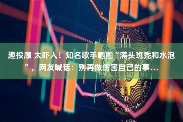 趣投顾 太吓人！知名歌手晒图“满头斑秃和水泡”，网友喊话：别再做伤害自己的事…